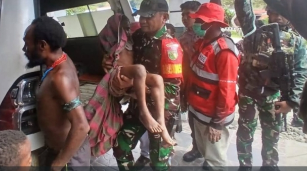 Warga sipil korban konflik di Puncak Papua menjalani perawatan medis di rumah sakit.